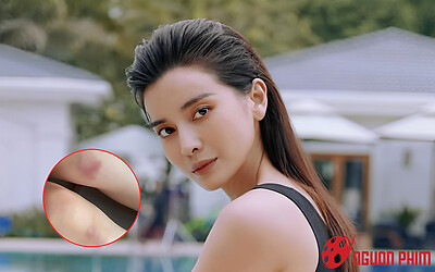 Cao Thái Hà bị thương tích đầy mình