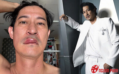 Huy Khánh gặp biến cố sức khỏe hậu ly hôn