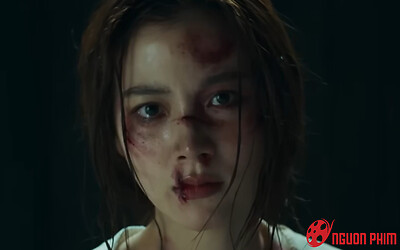 Không nhận ra nữ diễn viên xinh đẹp bậc nhất showbiz khi lộ diện với gương mặt bầm dập