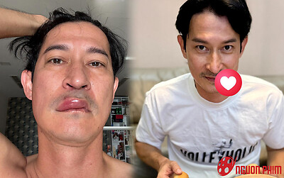 Tình trạng hiện tại của Huy Khánh sau biến cố sức khỏe